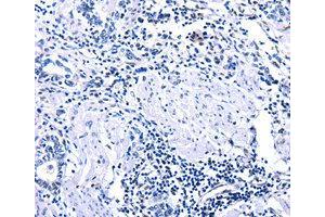 Immunohistochemistry (IHC) image for anti-DNA (Cytosine-5-)-Methyltransferase 3 alpha (DNMT3A) antibody (ABIN1872325) (DNMT3A antibody)