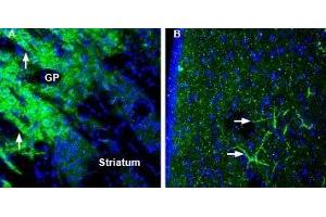 Expression of SynGAP in mouse globus pallidus and rat lateral septum - Immunohistochemical staining of perfusion-fixed frozen mouse and rat brain sections using Anti-SynGAP Antibody (ABIN7043789, ABIN7045176 and ABIN7045177), (1:200), followed by goat-anti-rabbit-AlexaFluor-488. (SYNGAP1 antibody  (C-Term))