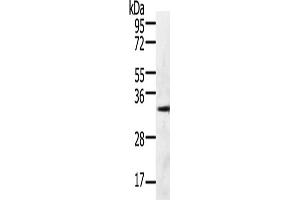 Gel: 10 % SDS-PAGE, Lysate: 60 μg, Lane: 293T cells, Primary antibody: ABIN7190790(GFRA4 Antibody) at dilution 1/600, Secondary antibody: Goat anti rabbit IgG at 1/8000 dilution, Exposure time: 30 seconds (GFRA4 antibody)