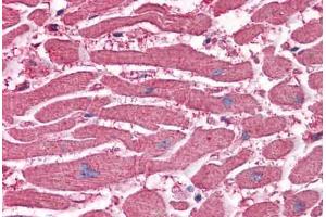 Human Heart: Formalin-Fixed, Paraffin-Embedded (FFPE) (EDEM2 antibody  (AA 479-579))