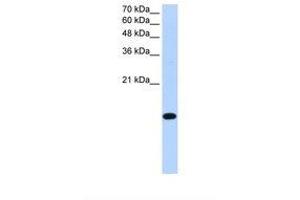 Image no. 1 for anti-Basic Leucine Zipper Transcription Factor, ATF-Like 2 (BATF2) (AA 116-165) antibody (ABIN6739212) (BATF2 antibody  (AA 116-165))