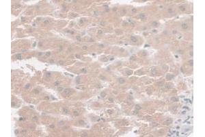 IHC-P analysis of Human Liver Tissue, with DAB staining. (SYNE2 antibody  (AA 6-296))