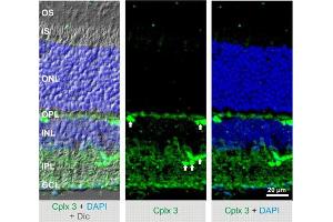 Indirect immunostaining of mouse retina (dilution 1 : 500). (CPLX3 antibody)