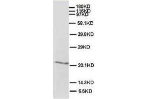 Western blot analysis of rat brain tissue lysis using SHH antibody (Sonic Hedgehog antibody  (N-Term))
