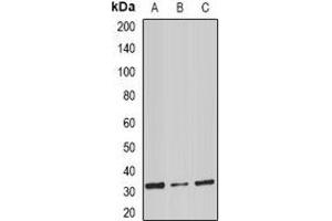 Western blot analysis of Stomatin expression in mouse spleen (A), mouse heart (B), rat liver (C) whole cell lysates. (Stomatin antibody)