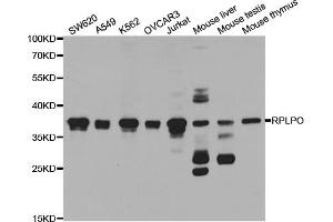 Western blot analysis of extracts of various cell lines, using RPLP0 antibody (ABIN5973238) at 1/1000 dilution. (RPLP0 antibody)