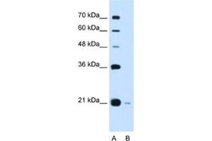 Western Blotting (WB) image for anti-DCTP Pyrophosphatase 1 (DCTPP1) antibody (ABIN2462972) (DCTPP1 antibody)