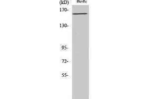 Western Blot (WB) analysis of specific cells using Phospho-Flk-1 (Y1175) Polyclonal Antibody. (VEGFR2/CD309 antibody  (pTyr1175))