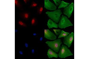 ABIN6259146 and ABIN6273735 staining  cells by IF/ICC.