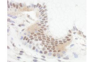 Immunohistochemistry (IHC) image for anti-B-Cell CLL/lymphoma 11B (Zinc Finger Protein) (BCL11B) (AA 500-550) antibody (ABIN7454621) (BCL11B antibody  (AA 500-550))