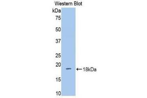 Western Blotting (WB) image for anti-Dipeptidyl-Peptidase 4 (DPP4) (AA 631-760) antibody (ABIN1858663)