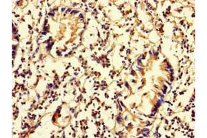Immunohistochemistry of paraffin-embedded human appendix tissue using ABIN7150849 at dilution of 1:100 (DNAAF3 antibody  (AA 1-209))