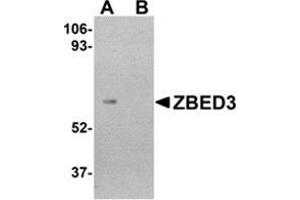 Western blot analysis of ZBED3 in human lung tissue lysate with this product at 1 μg/ml in (A) the absence and (B) the presence of blocking peptide. (ZBED3 antibody  (C-Term))