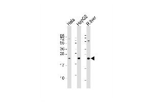 Western Blot at 1:2000 dilution Lane 1: Hela whole cell lysate Lane 2: HepG2 whole cell lysate Lane 3: rat liver lysate Lysates/proteins at 20 ug per lane.