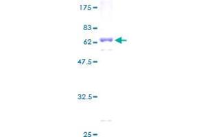 PRSS8 Protein (AA 1-343) (GST tag)