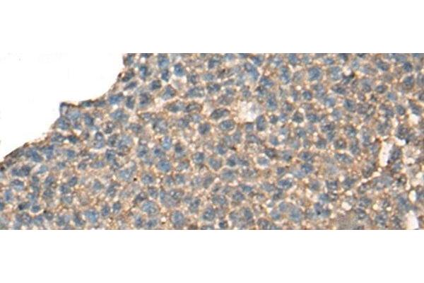 CABP5 antibody
