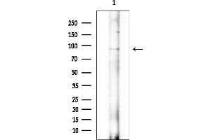 Western blot analysis of lysates from EC304 cells(heat-shock treatment), using RHG6 Antibody at 1/1000 dilution. (RHG6 (Internal Region) antibody)