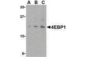 Western Blotting (WB) image for anti-Eukaryotic Translation Initiation Factor 4E Binding Protein 1 (EIF4EBP1) (C-Term) antibody (ABIN2477208) (eIF4EBP1 antibody  (C-Term))