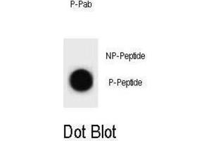 Dot Blot (DB) image for anti-Cyclin B2 (CCNB2) (pThr359) antibody (ABIN3002075) (Cyclin B2 antibody  (pThr359))