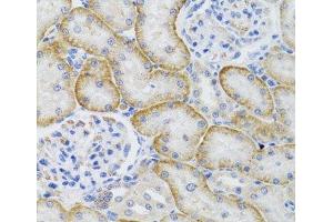 Immunohistochemistry of paraffin-embedded Rat kidney using ARFGAP1 Polyclonal Antibody at dilution of 1:100 (40x lens). (ARFGAP1 antibody)