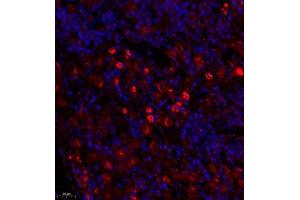Immunofluorescence (Paraffin-embedded Sections) (IF (p)) image for anti-Tumor Necrosis Factor Receptor Superfamily, Member 17 (TNFRSF17) antibody (ABIN7076067)