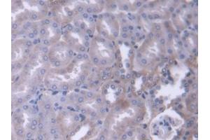 Detection of ADD1 in Mouse Kidney Tissue using Polyclonal Antibody to Alpha Adducin (ADD1)
