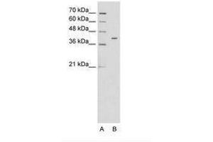 Image no. 1 for anti-Pregnancy Specific beta-1-Glycoprotein 6 (PSG6) (AA 51-100) antibody (ABIN6736625) (PSG6 antibody  (AA 51-100))
