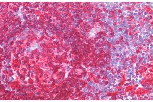 ABIN2613404 (5 μg/mL) staining of paraffin embedded Human Spleen. (CD74 antibody  (AA 159-171))