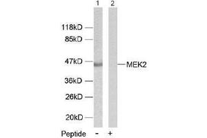 Image no. 1 for anti-Mitogen-Activated Protein Kinase Kinase 2 (MAP2K2) (Thr394) antibody (ABIN197107) (MEK2 antibody  (Thr394))