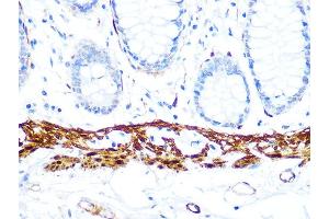 Immunohistochemistry of paraffin-embedded human colon using Calponin Rabbit mAb (ABIN1678670, ABIN3018018, ABIN3018019 and ABIN7101568) at dilution of 1:100 (40x lens). (CNN1 antibody)