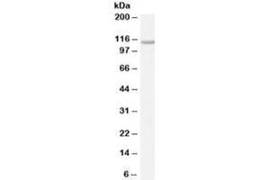 Western blot testing of K562 cell lysate with VDP p115 antibody at 0. (USO1 antibody)