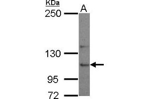 Western Blotting (WB) image for anti-Ubiquitin Specific Peptidase 26 (USP26) (C-Term) antibody (ABIN1491907)
