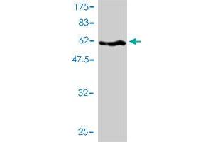 Western Blot detection against Immunogen (71. (SERPINH1 antibody  (AA 1-418))