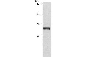 Western Blot analysis of Lovo cell using KLC1 Polyclonal Antibody at dilution of 1:500