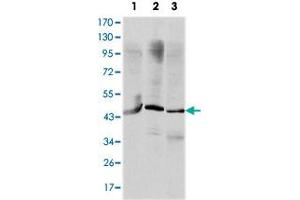 Western blot analysis using OTX2 monoclonal antobody, clone 1H12G8B2  against HepG2 (1), Jurkat (2), and NTERA-2 (3) cell lysate.