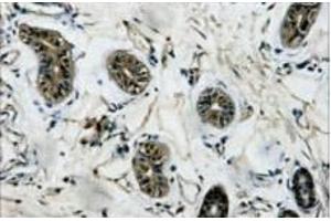 Immunohistochemistry of paraffin-embedded Human colon tissue using beta Tubulin Monoclonal Antibody at dilution of 1:200. (TUBB antibody)