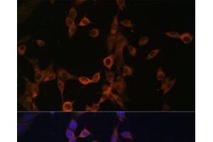 Immunofluorescence analysis of NIH/3T3 cells using PPP3R1 Polyclonal Antibody at dilution of 1:100.