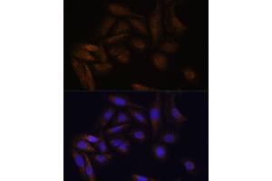 Immunofluorescence analysis of U-2 OS cells using TF antibody (ABIN7270888) at dilution of 1:100. (TFAP4 antibody)
