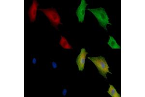 ABIN7096899 and ABIN7100965 staining  cells by IF/ICC. (MBOAT1 antibody)