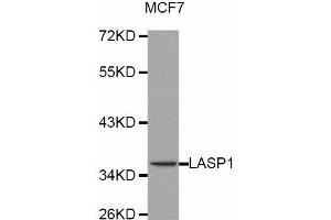 Western Blotting (WB) image for anti-LIM and SH3 Protein 1 (LASP1) antibody (ABIN1873516) (LASP1 antibody)