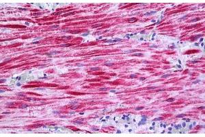 Human Intestine: Formalin-Fixed, Paraffin-Embedded (FFPE) (PKD2 antibody  (AA 829-878))