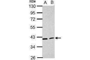 WB Image Sample (30 ug of whole cell lysate) A: H1299 B: HCT116 10% SDS PAGE antibody diluted at 1:1000 (ACADL antibody  (N-Term))