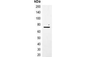 Immunoprecipitation of mCherry-tagged protein from HEK293T cells transfected with vector overexpressing mCherry tag, using Anti-mCherry-tag Antibody. (mCherry antibody)