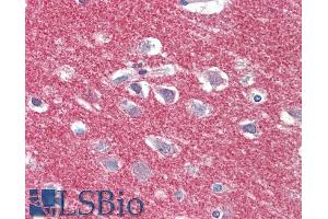 Immunohistochemistry (IHC) image for anti-Adaptor-Related Protein Complex 2, alpha 1 Subunit (AP2A1) (AA 706-727) antibody (ABIN5539681)