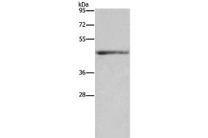Western Blot analysis of Mouse heart tissue using IL5RA Polyclonal Antibody at dilution of 1:650 (IL5RA antibody)