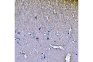 IHC analysis of SH3GL2 using anti-SH3GL2 antibody (ABIN7602229). (SH3G2 antibody  (AA 65-292))