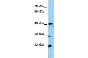 WB Suggested Anti-Gm13152 Antibody Titration: 1. (Zfp982 antibody  (N-Term))