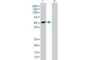 Western Blot analysis of CRLF1 expression in transfected 293T cell line by CRLF1 MaxPab polyclonal antibody. (CRLF1 antibody  (AA 1-422))