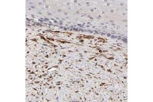 Immunohistochemical staining of human esophagus with SPARC polyclonal antibody  shows distinct positivity in fibroblasts.