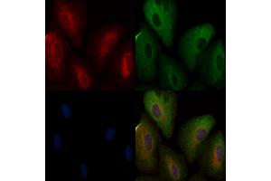 ABIN6257946 and ABIN6274871 staining  cells by IF/ICC. (Ataxin 2-Like antibody  (Internal Region))